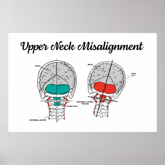 Chiropraktikum Oberzervikal Poster (Vorne)