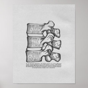 Chiropraktikvertebraler Subluxations-Vintager Poster