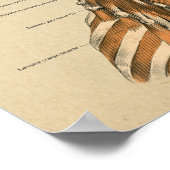 Chiropraktische Massagediagramm der Nackenspine Poster (Ecke)