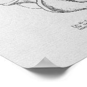 Chiropraktische vertebrale Subluxation Vintag Prin Poster (Ecke)