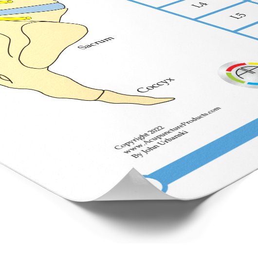 Chiropraktische Wirbelsäulensubluxation Komplex Po Poster (Ecke)