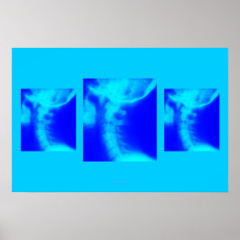 Chiropraktisches Poster: Laterale zervikale Blues Poster