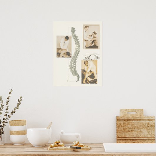 Chiropraktisches Spinalanpassungspaket Poster (Küche)
