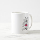 Chiropraktor-Rückenchirurg Kaffeetasse (VorderseiteRechts)
