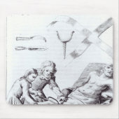 Chirurgische Operation, zum eines Beines zu Mousepad (Vorne)