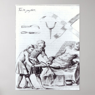 Chirurgische Operation, zum eines Beines zu Poster