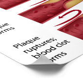 Cholesterin-Tafel Bühnen Poster (Ecke)