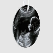 Christmas Baby Sonogram Picture Gift Ornament (Vorderseite)
