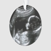 Christmas Baby Sonogram Picture Gift Ornament (Vorderseite)