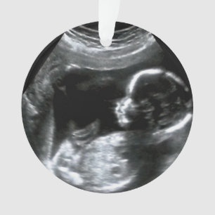 Christmas Baby Sonogram Picture Gift Ornament