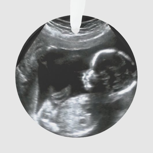 Christmas Baby Sonogram Picture Gift Ornament (Vorderseite)