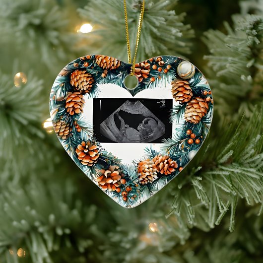 Christmas Pregnancy Ultrasound Baby On The Way Keramik Ornament