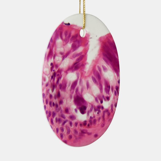 Ciliated Epithel unter dem Mikroskop Keramikornament (Rechts)