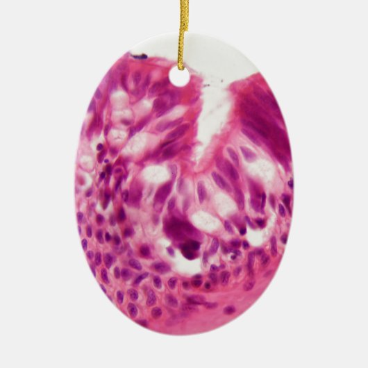 Ciliated Epithel unter dem Mikroskop Keramikornament (Vorne)