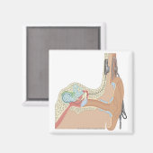 Cochlear Implantate Magnet (Vorderseite/Rückseite)