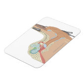 Cochlear Implantate Magnet (Linke Seite)