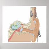 Cochlear Implantate Poster (Vorne)