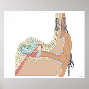 Cochlear Implantate Poster