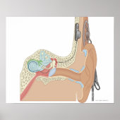 Cochlear Implantate Poster (Vorne)