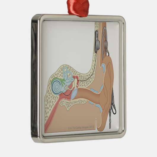 Cochlear- Implantate Silbernes Ornament (Rechts)