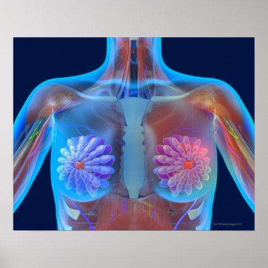 Computer artwork representing breast cancer, poster (Vorne)