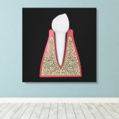 Conceptual Image of Human Tooth 1 Leinwanddruck (Insitu (Holzboden))