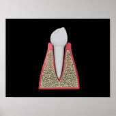 Conceptual Image of Human Tooth 1 Poster (Vorne)