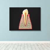 Conceptual Image of Human Tooth 2 Leinwanddruck (Insitu (Holzboden))