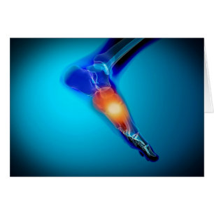 Conceptual Image of Pain in Human Foot