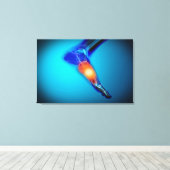 Conceptual Image of Pain in Human Foot Leinwanddruck (Insitu (Holzboden))