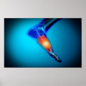 Conceptual Image of Pain in Human Foot Poster (Vorne)