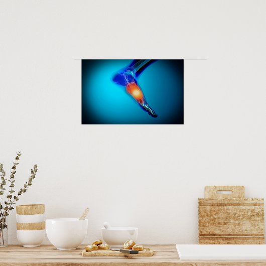 Conceptual Image of Pain in Human Foot Poster (Küche)