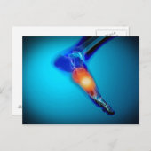 Conceptual Image of Pain in Human Foot Postkarte (Vorne/Hinten)