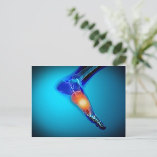 Conceptual Image of Pain in Human Foot Postkarte (Stehend Vorderseite)