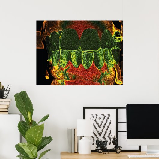 Crazy Teeth Bite Dentist Orthodontist Poster (Heimbüro)