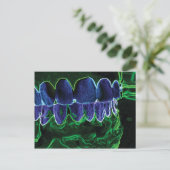 Crazy Teeth Model Dentist Orthodontist Card Postkarte (Stehend Vorderseite)