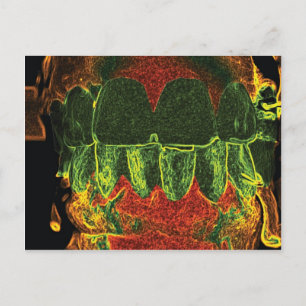 Crazy Teeth Model Design Zahnarzt Orthodontist Kar Postkarte