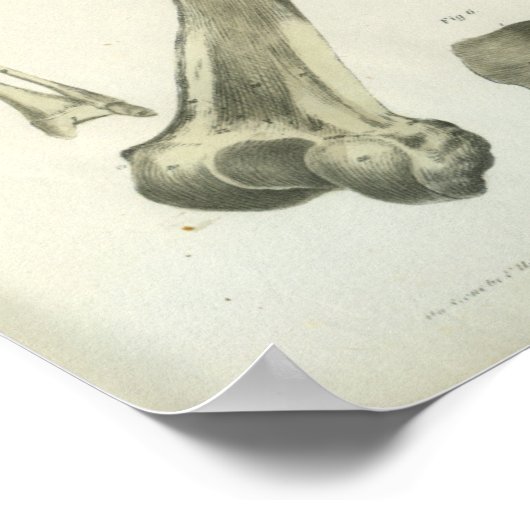 Crossed Femur Knochen Anatomie Kunst Poster (Ecke)