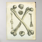 Crossed Femur Knochen Anatomie Kunst Poster (Vorne)