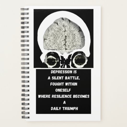 CT Scan_CTFOD_Dailicher Triumph Planer (Vorderseite)