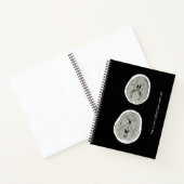 CT Scan_CTFOD_ So sieht Depression aus Notizblock (Innenseite)