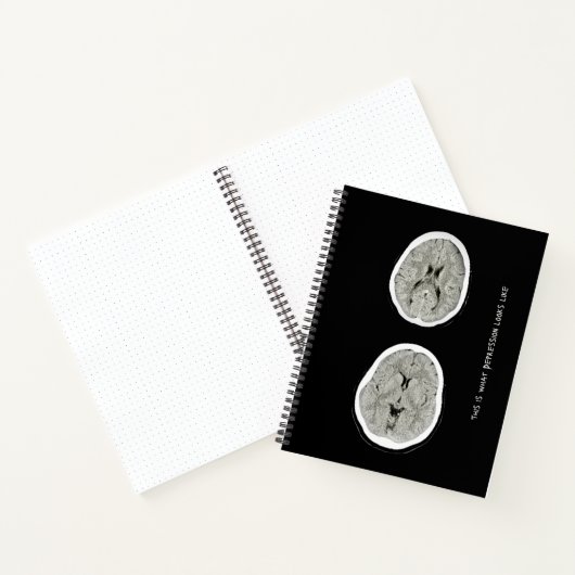 CT Scan_CTFOD_ So sieht Depression aus Notizblock (Innenseite)