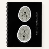 CT Scan_CTFOD_ So sieht Depression aus Notizblock (Vorderseite)