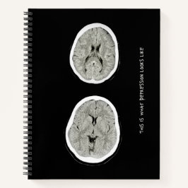 CT Scan_CTFOD_ So sieht Depression aus Notizblock