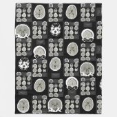 CT Scan_this is depression_BLK_CTFOD Fleecedecke (Vorderseite)