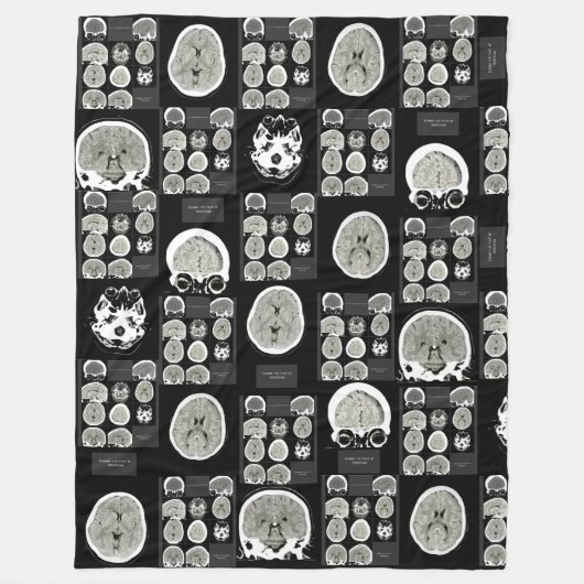 CT Scan_this is depression_BLK_CTFOD Fleecedecke (Vorderseite)