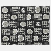 CT Scan_this is depression_BLK_CTFOD Fleecedecke (Vorderseite (Horizontal))