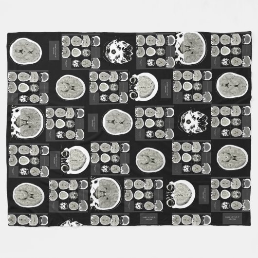 CT Scan_this is depression_BLK_CTFOD Fleecedecke (Vorderseite (Horizontal))