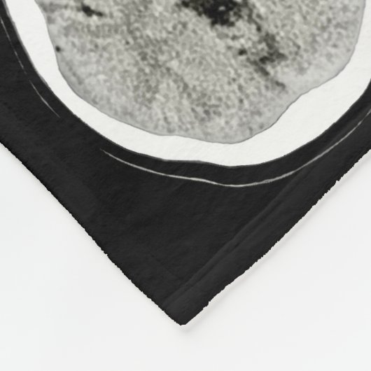 CT Scan_this is depression_BLK_CTFOD Fleecedecke (Ecke)