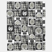 CT Scan_this is depression_CTFOD Fleecedecke (Vorderseite)